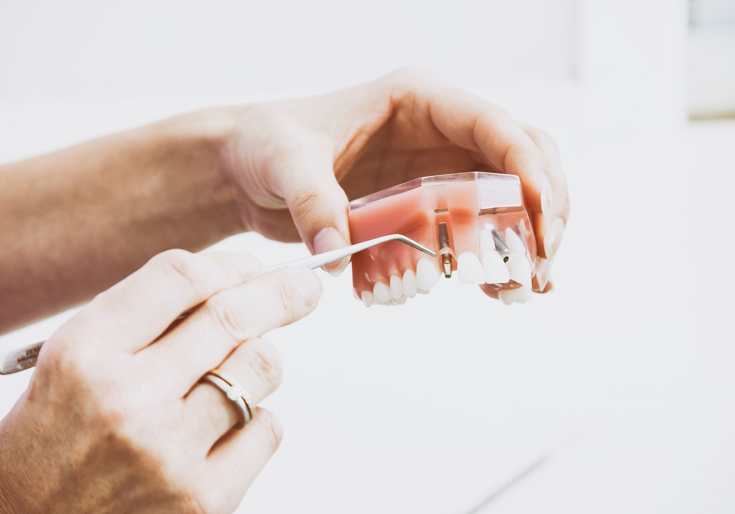 Zahnersatz Implantat